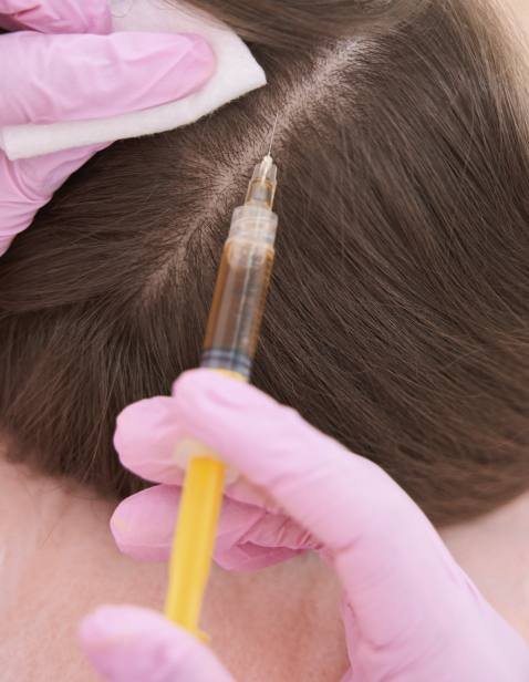 img-exosomas-capilar-01