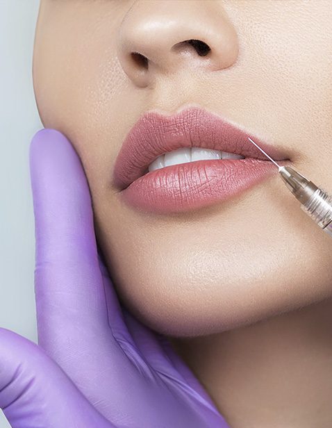 img-labios-01